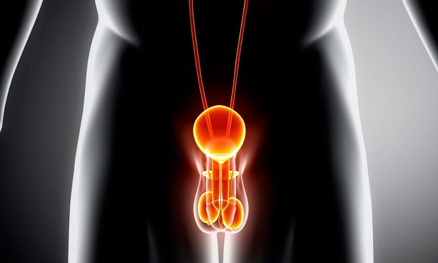Sistema xenitourinario inflamado para a prostatite